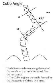 Cobb Angle